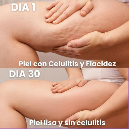 SlimLeggys - Adios Celulitis!
